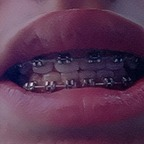 View bracesfetish (Braces fetish) OnlyFans 49 Photos and 32 Videos gallery 

 profile picture